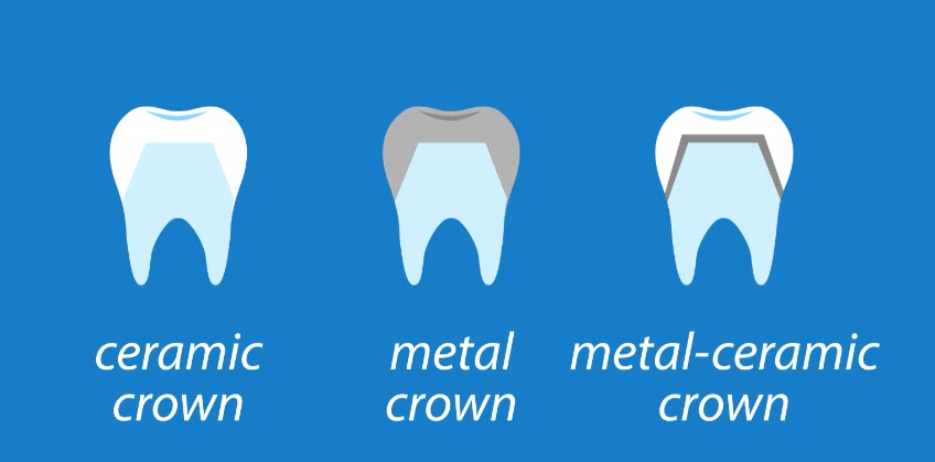 Crown materials