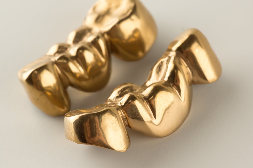 Gold Crowns