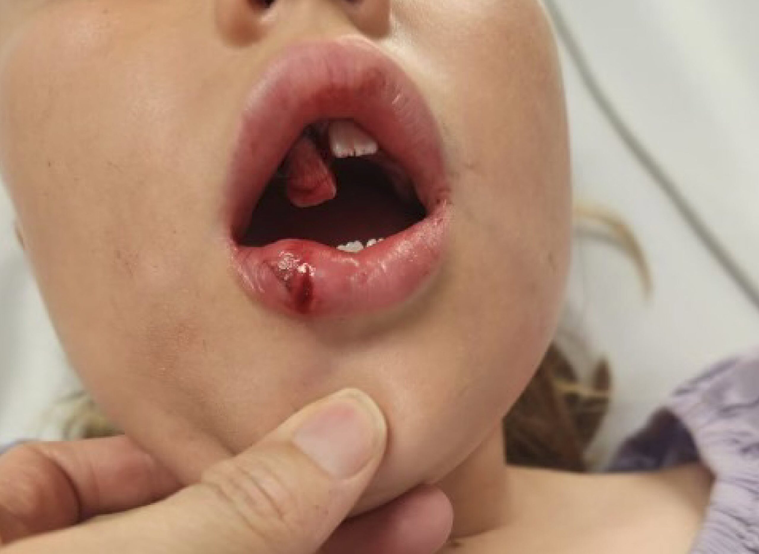 urgent dental situations and tooth injuries