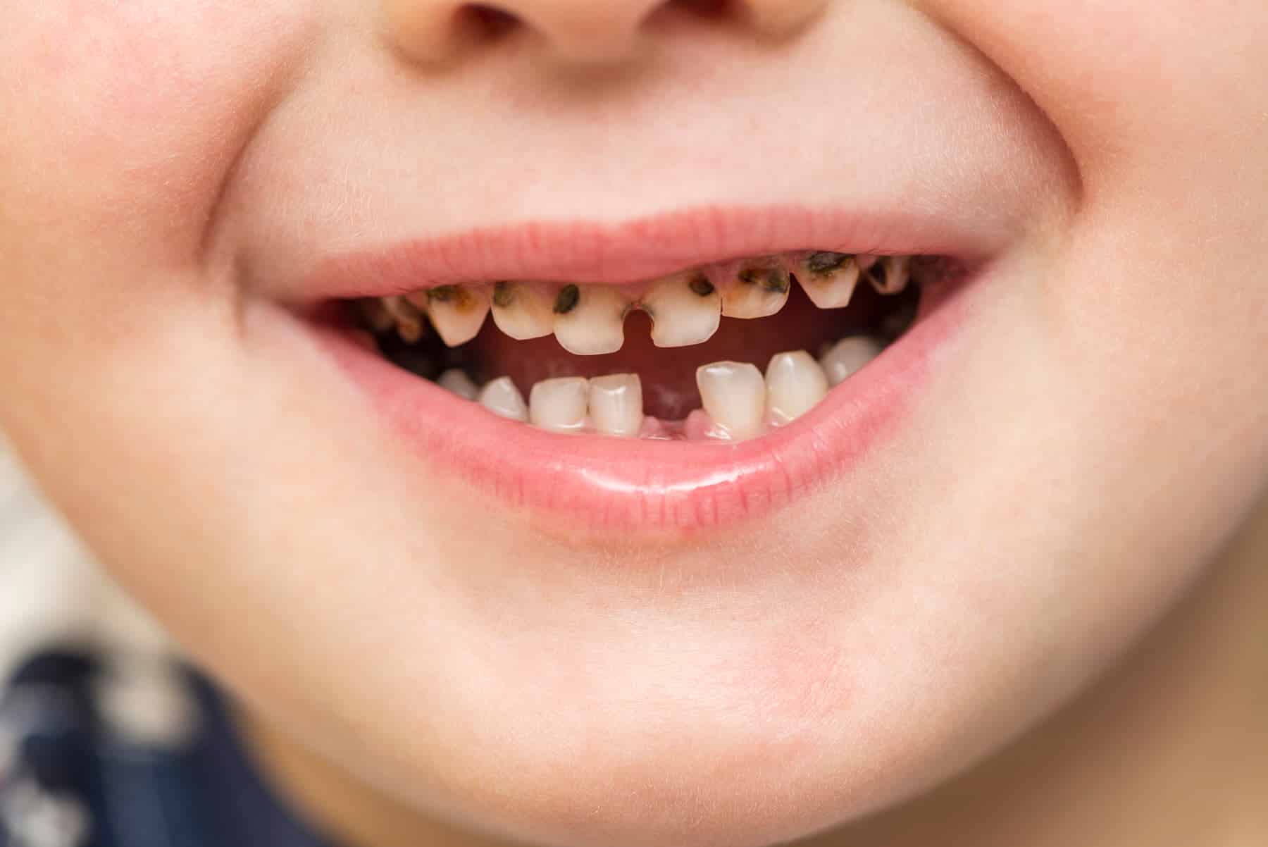 special needs pediatric dentist for baby teeth