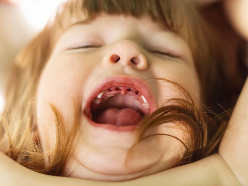a little girl smiling with all the front teeth missing