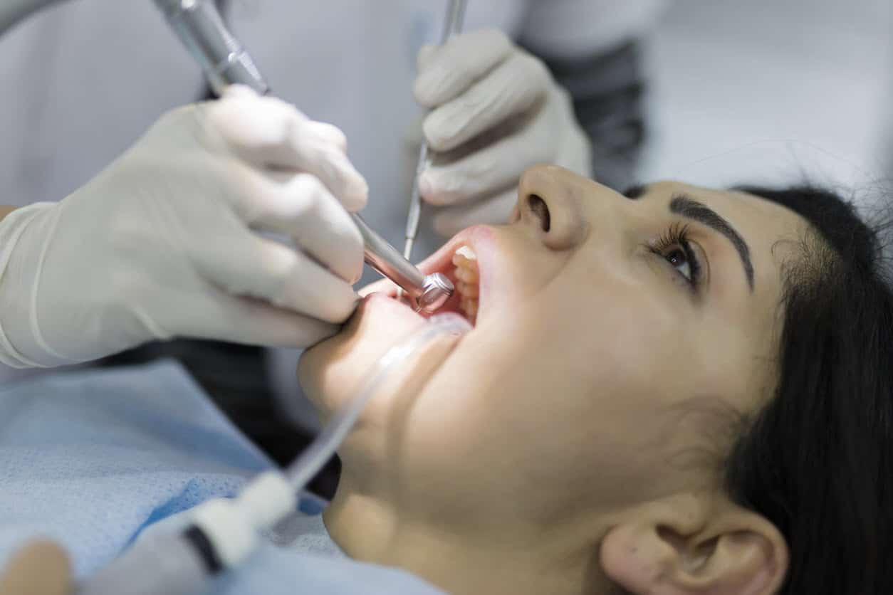 Dental scale and clean Brisbane
