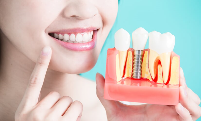 Dental Crown for Implants