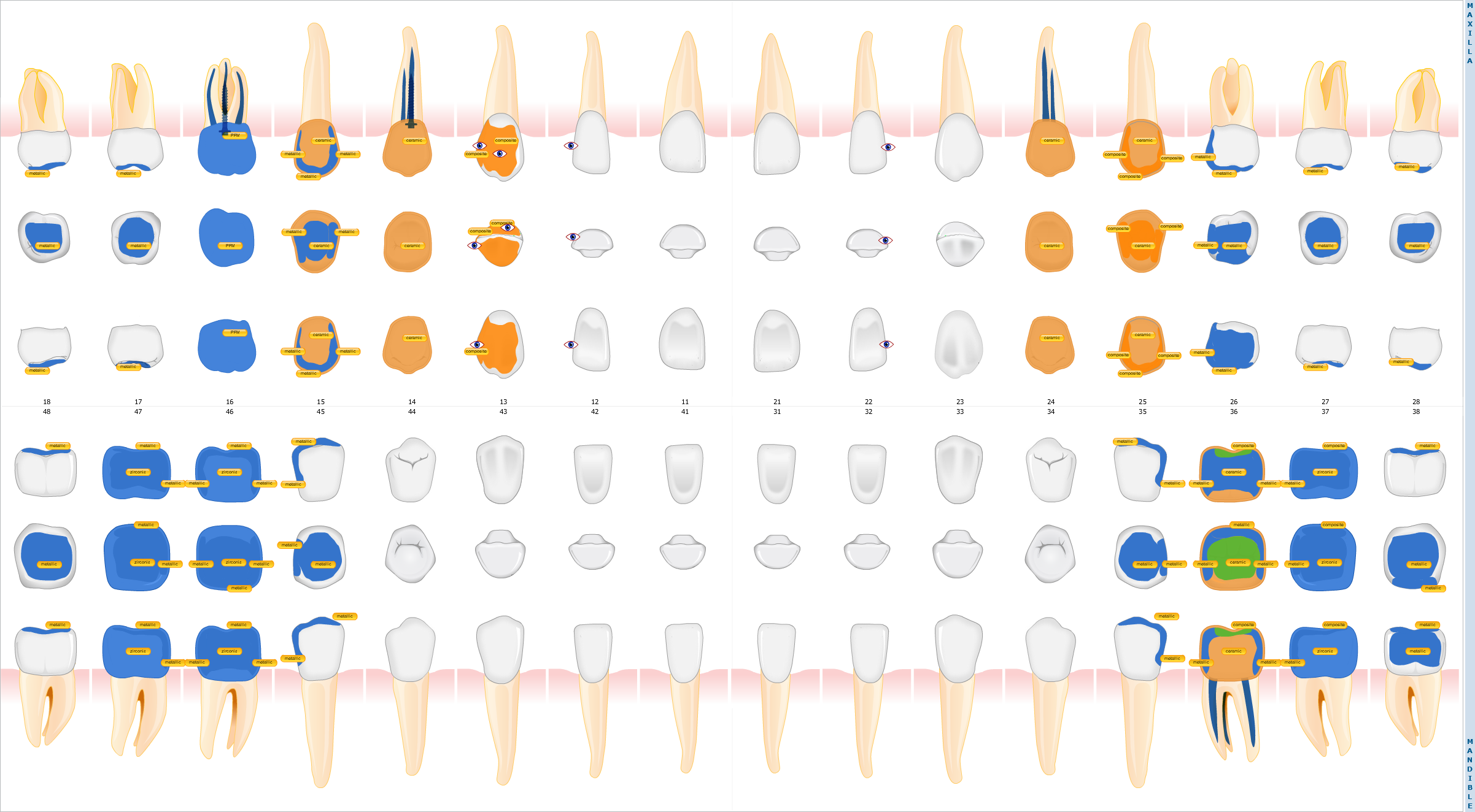 Tooth Chart of a patient