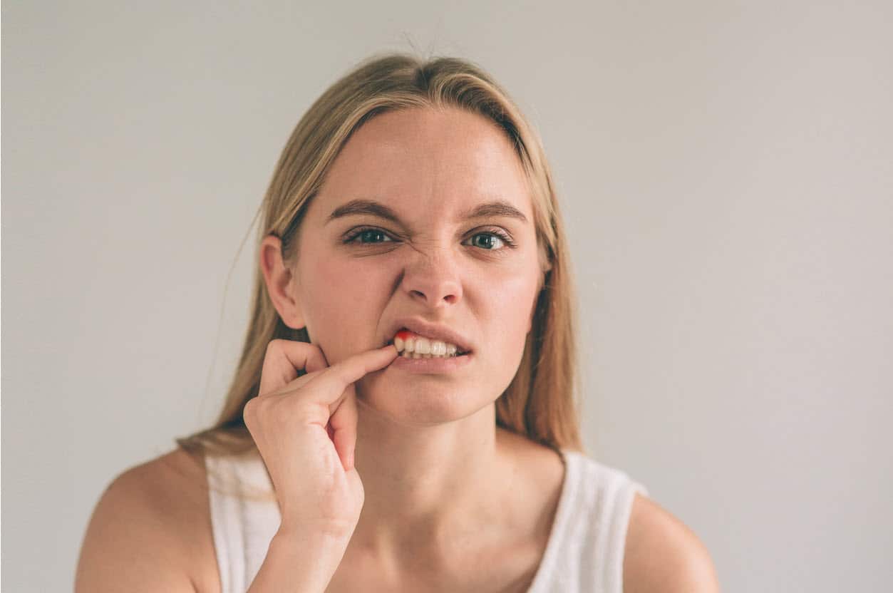 woman-checking-teeth-and-gums