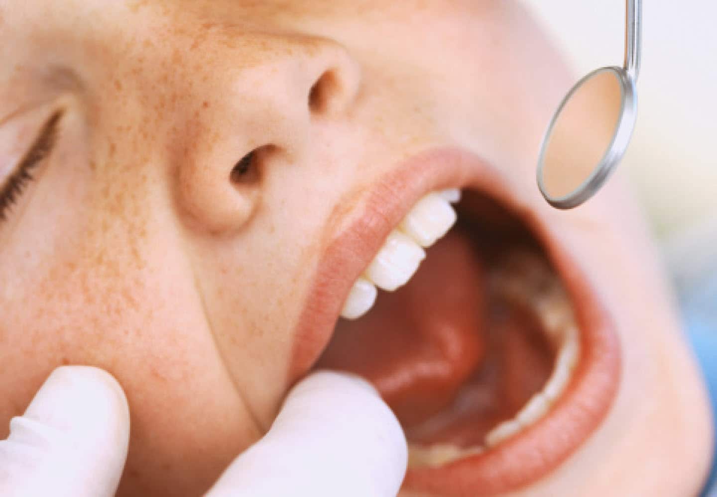 Young children with dental pain