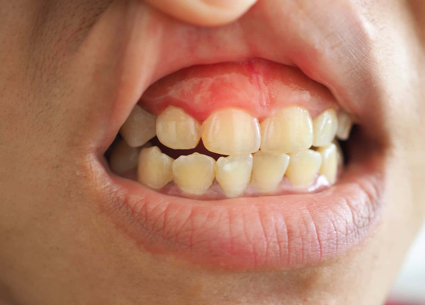 gum issues dentist Brisbane