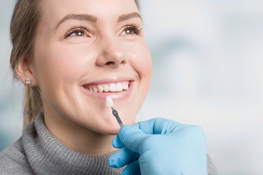 Achieve a Hollywood smile with porcelain dental veneers