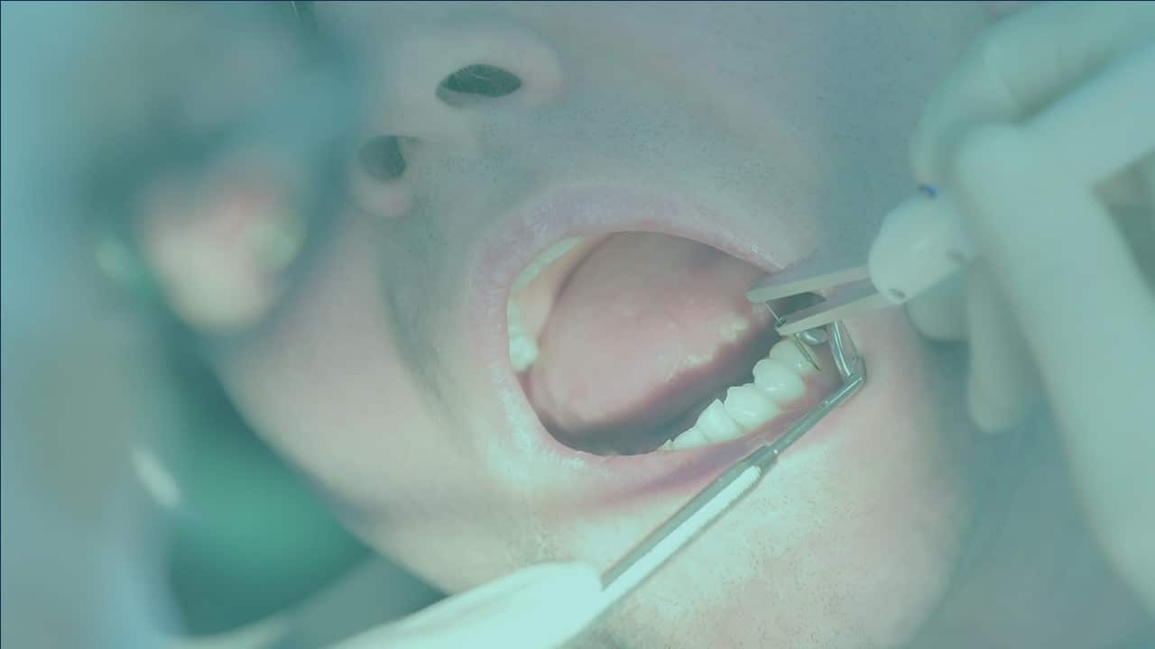 Special needs dentistry services